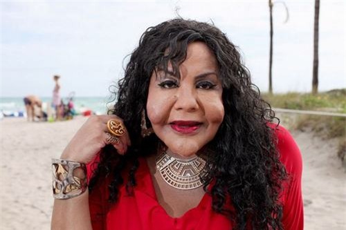 Tiền mất tật mang, thân tàn ma dại chỉ vì phẫu thuật thẩm mỹ 'chui'-2