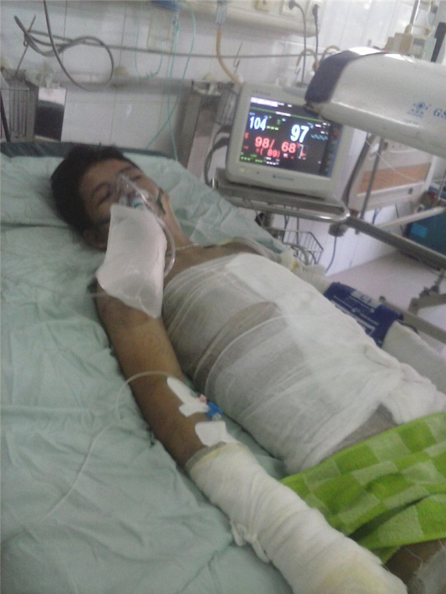 chay-xuong-san-xuat-banh-keo-o-ha-noi-2-benh-nhan-dang-cap-cuu-van-hon-me-nguoi-than-dung-ngoi-khong-yen-2