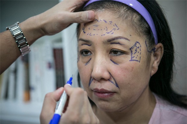 Trung Quốc: Trốn nợ thẻ tín dụng 120 tỷ, người phụ nữ đi phẫu thuật thẩm mỹ để không ai biết mặt - Ảnh 1.