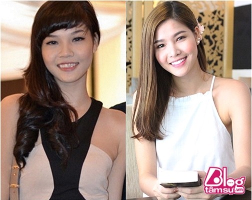 thanh-bi-mai-rang-blogtamsuvn7