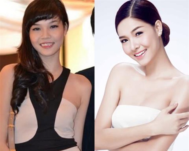 Sao Việt phẫu thuật thẩm mỹ - hành trình lột xác gian nan, ồn ào - Ảnh 12.