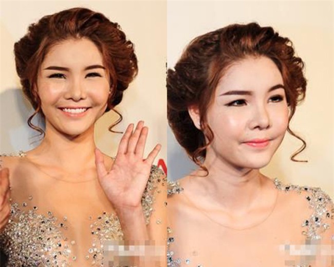 Sao Việt phẫu thuật thẩm mỹ - hành trình lột xác gian nan, ồn ào - Ảnh 13.