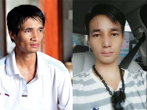 Cùng đại giải phẫu cơ thể nhưng sao Việt người được ủng hộ - kẻ chịu dèm pha-13