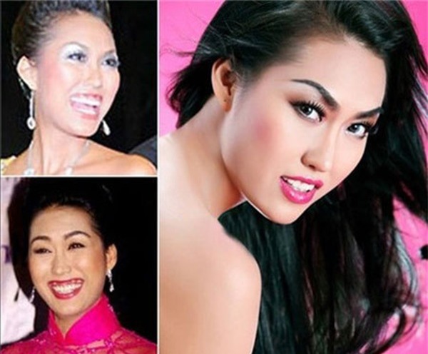 Cùng đại giải phẫu cơ thể nhưng sao Việt người được ủng hộ - kẻ chịu dèm pha-4