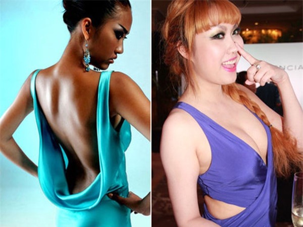 Cùng đại giải phẫu cơ thể nhưng sao Việt người được ủng hộ - kẻ chịu dèm pha-5