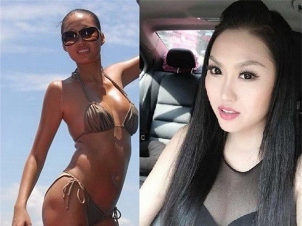 Cùng đại giải phẫu cơ thể nhưng sao Việt người được ủng hộ - kẻ chịu dèm pha-6