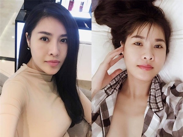 Cùng đại giải phẫu cơ thể nhưng sao Việt người được ủng hộ - kẻ chịu dèm pha-9