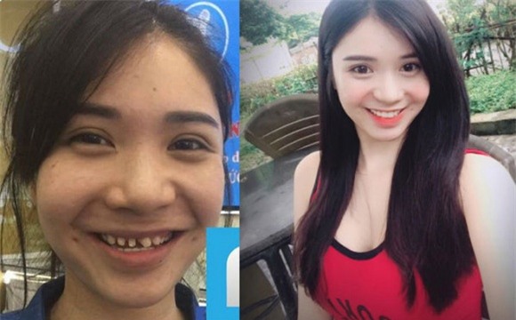 chuyện làng sao,sao Việt,Thanh Bi,phẫu thuật thẩm mỹ,người phán xử,Vân Điệp