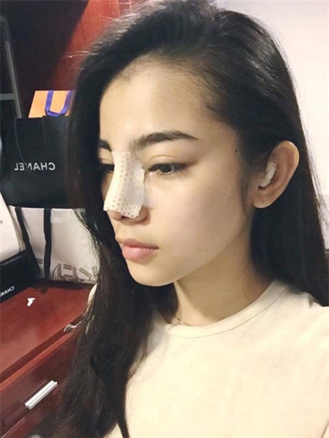 Mãn nhãn ngắm 9X Cần Thơ từ 'vịt hóa thiên nga' nhờ dao kéo-3