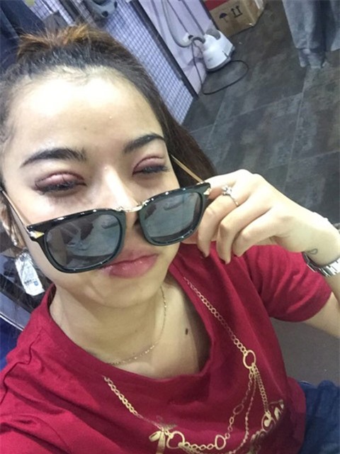 Mãn nhãn ngắm 9X Cần Thơ từ 'vịt hóa thiên nga' nhờ dao kéo-5