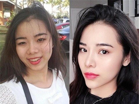 Mãn nhãn ngắm 9X Cần Thơ từ 'vịt hóa thiên nga' nhờ dao kéo-6