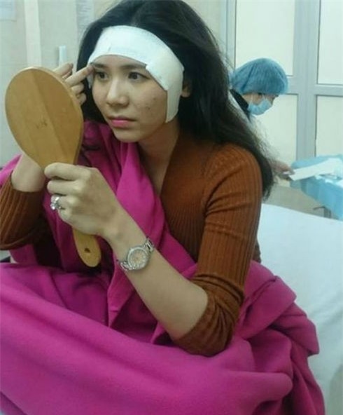 thuc hu chuyen thanh bi