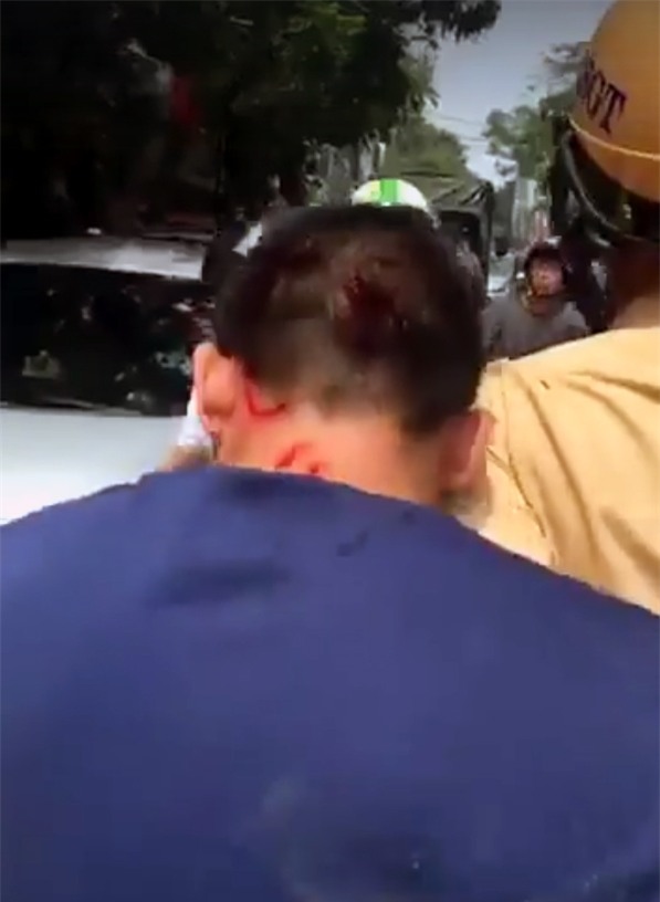 Tài xế ô tô bị một số thương tích trên đầu.