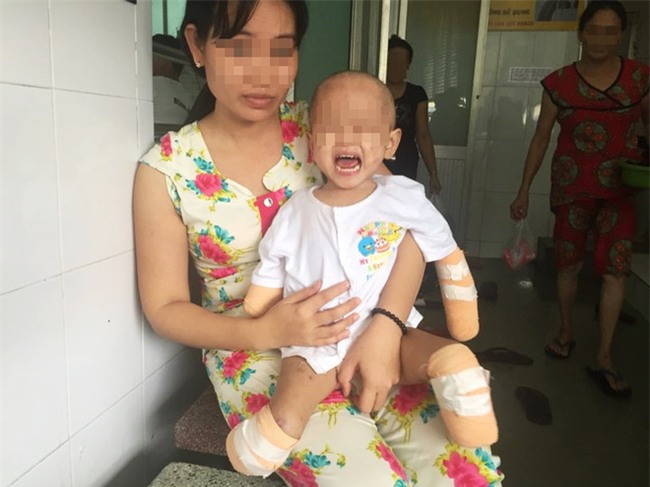 TP.HCM: Xót xa bé gái 2 tuổi bị đoạn tứ chi vì viêm não mô cầu - Ảnh 1.