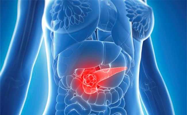 1 triệu chứng sau ăn cảnh báo 3 bệnh ung thư nguy hiểm: Chớ coi thường!