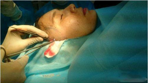 Thanh Bi len tieng ve loat anh phau thuat tham my can canh hinh anh 2