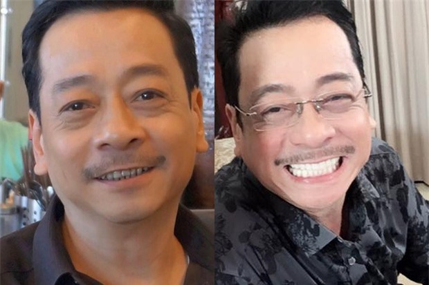 Sau Phan Hải, đến ông trùm Phan Quân của Người phán xử cũng đã gia nhập hội răng sứ! - Ảnh 1.