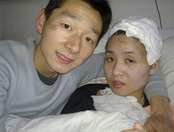 ban gai ngay ngo nhu tre len 3 sau tai nan, chang trai van cuoi ve cham soc va cai ket xuc dong sau 7 nam - 3