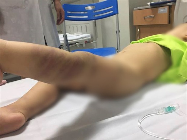Công an Hà Nội khởi tố vụ bé trai bị bỏ rơi ở bệnh viện có nhiều vết thương tích - Ảnh 1.