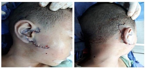 nga tu tren ghe xuong dat, chau be 5 tuoi suyt bi dut lia mot ben tai - 1