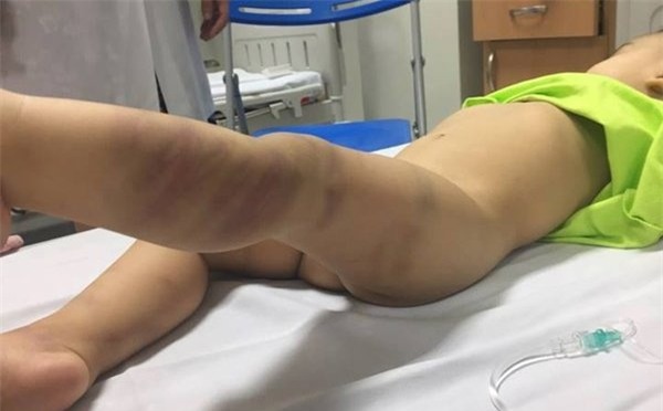 bạo hành trẻ em, ngược đãi trẻ em, Hà Nội