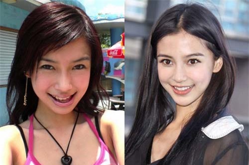 loat anh truoc - sau cua sao viet cho thay suc manh ghe gom cua viec chinh rang - 10