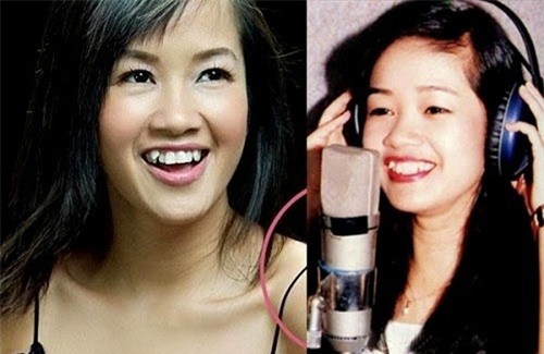 loat anh truoc - sau cua sao viet cho thay suc manh ghe gom cua viec chinh rang - 3