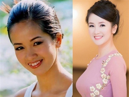 loat anh truoc - sau cua sao viet cho thay suc manh ghe gom cua viec chinh rang - 4