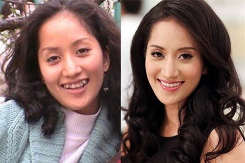 loat anh truoc - sau cua sao viet cho thay suc manh ghe gom cua viec chinh rang - 7