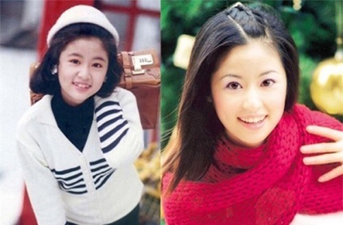 loat anh truoc - sau cua sao viet cho thay suc manh ghe gom cua viec chinh rang - 9