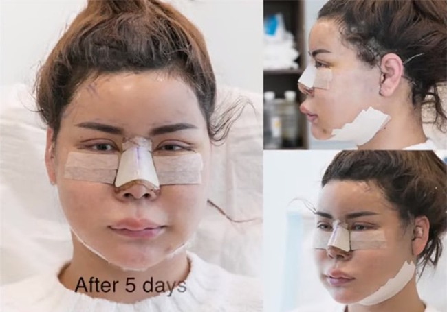 vo mong vi qua khu xau kho tin cua loat nam than, nu than thai lan hinh anh 8