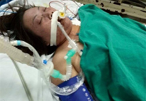 “ca van nguoi mac khong sao, ma me con lai bi sot xuat huyet hanh ha dau don the nay” - 2