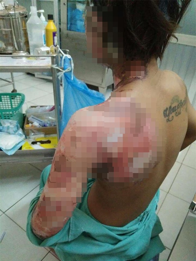 Giận vợ, chồng tưới xăng dọa đốt nhà, lửa bùng cháy gây bỏng cho cả đứa con mới hơn 2 tuổi  - Ảnh 1.