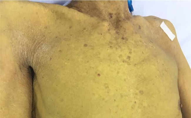 Người vàng ệch như củ nghệ vì thói quen nhà nào cũng mắc