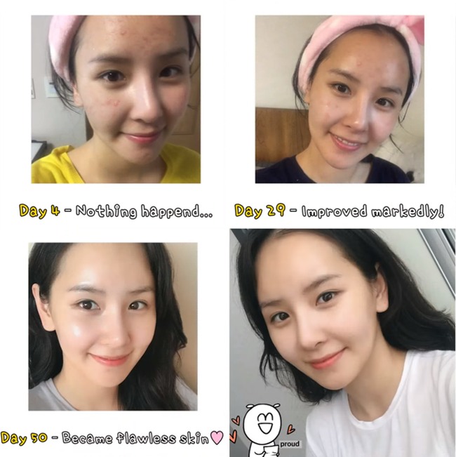 Trào lưu rửa mặt với toner để da sạch mụn, bóng mịn như người Hàn - Ảnh 2.