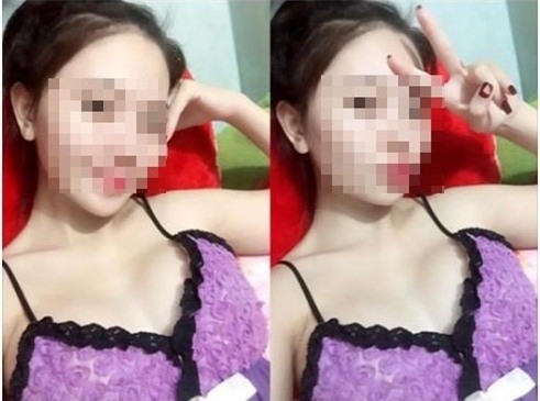 Kết quả hình ảnh cho Thai phụ chết sau khi nâng ngực