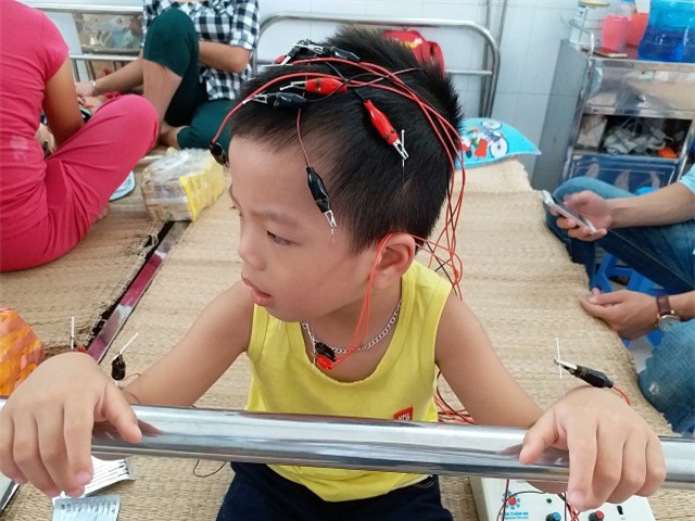 sinh ra con khong cat tieng khoc, 5 thang sau me dau don phat hien con bi bai nao - 5