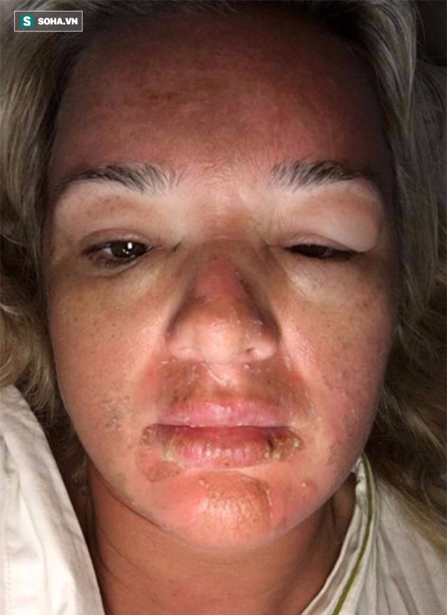 Chi 150 triệu để nâng ngực, mất hơn 1,5 tỷ sửa sai! - Ảnh 3.