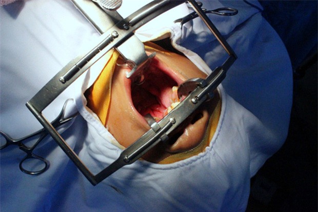 Bị người nhà đòi để cho chết, mẹ cậu bé “mặt quỷ” kiên quyết giữ lại mạng sống con trai - Ảnh 5.