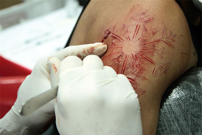 Những nguy cơ khi xăm mình, xỏ khuyên - Ảnh 2.