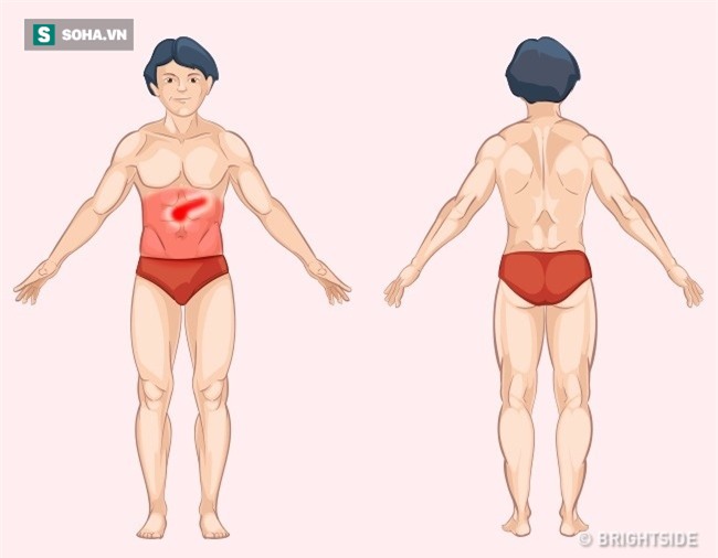 Đau ở đâu trên cơ thể thì nguy hiểm? Hình ảnh này là câu trả lời! - Ảnh 9.
