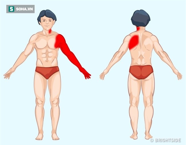 Đau ở đâu trên cơ thể thì nguy hiểm? Hình ảnh này là câu trả lời! - Ảnh 1.