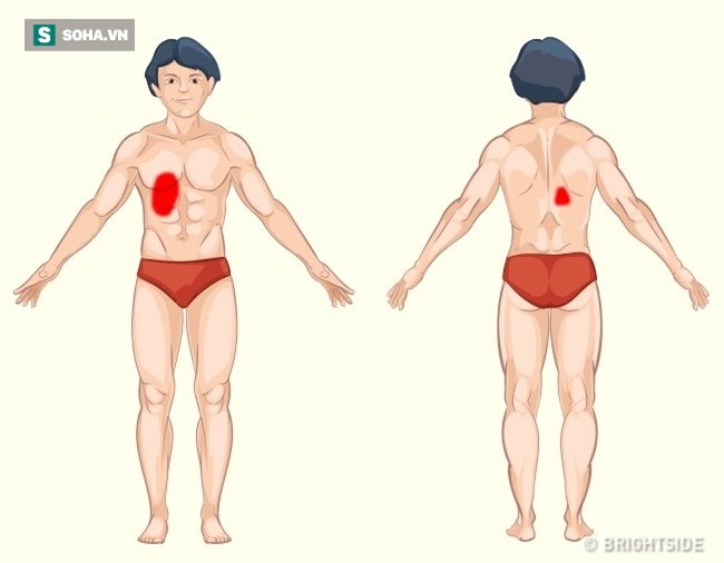 Đau ở đâu trên cơ thể thì nguy hiểm? Hình ảnh này là câu trả lời! - Ảnh 8.