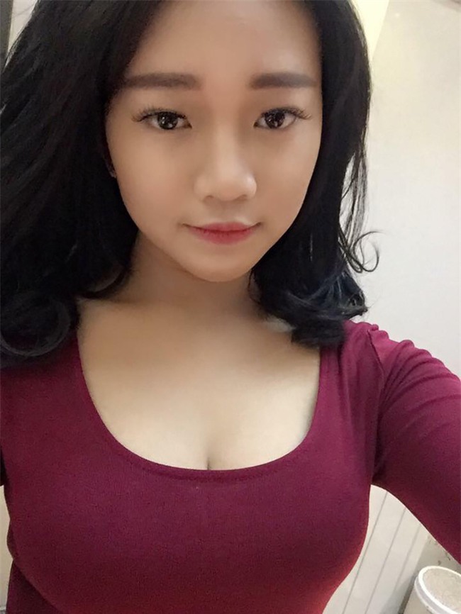 Muốn làm duyên bằng má lúm đồng tiền nhân tạo, cô gái trẻ bị áp-xe, má sưng như quả trứng - Ảnh 2.