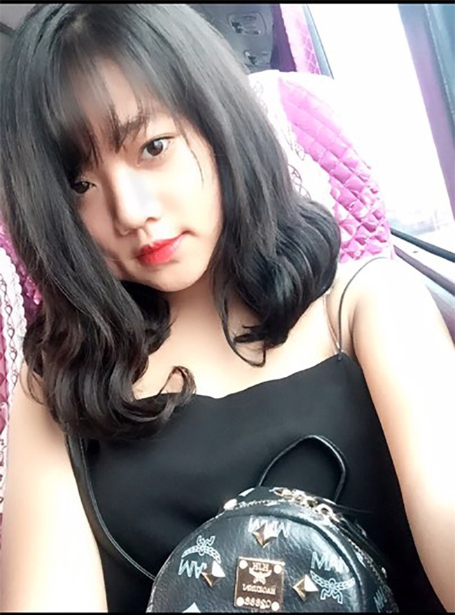 Muốn làm duyên bằng má lúm đồng tiền nhân tạo, cô gái trẻ bị áp-xe, má sưng như quả trứng - Ảnh 5.