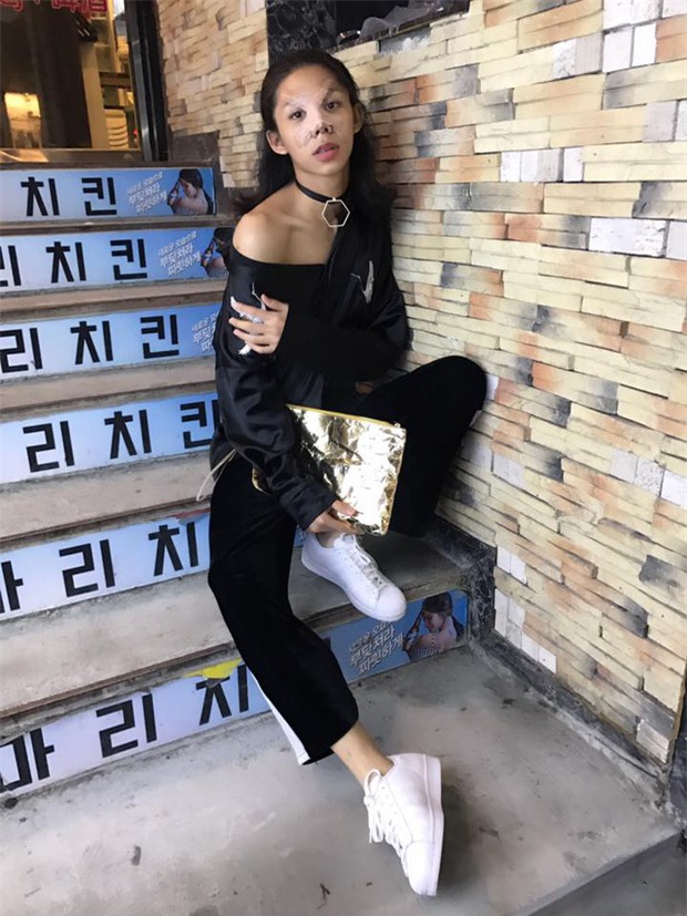 Không muốn đi một mình, anh chàng rủ bạn trai đồng tính sang Hàn Quốc để trùng tu nhan sắc - Ảnh 5.