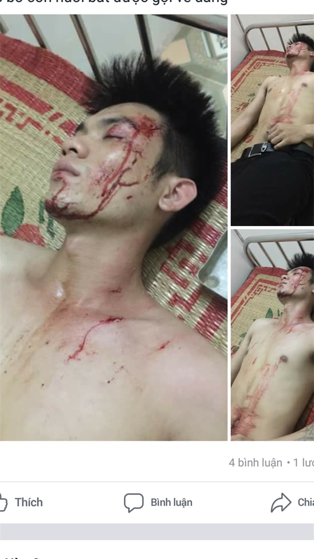Nam thanh niên được cho là H., con nuôi ông P., bị cho là bị ông P. đánh (ảnh: Facebook H.Q)