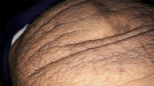 Bà mẹ 24 tuổi chia sẻ vết tích bụng rạn 13 ngày sau sinh nhìn đến xót xa - Ảnh 3.