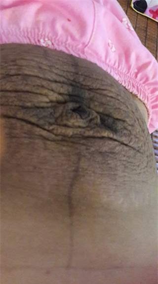 Bà mẹ 24 tuổi chia sẻ vết tích bụng rạn 13 ngày sau sinh nhìn đến xót xa - Ảnh 6.