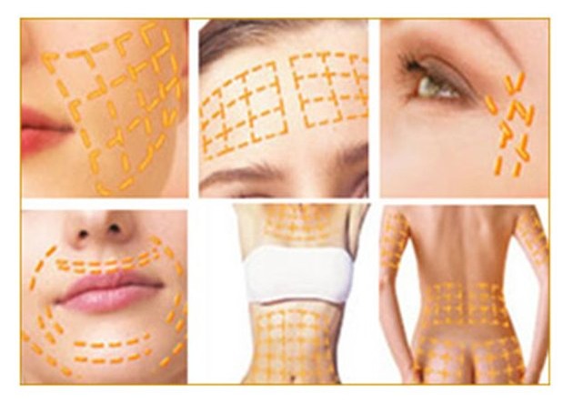 làm đẹp, dát vàng, nữ đại gia